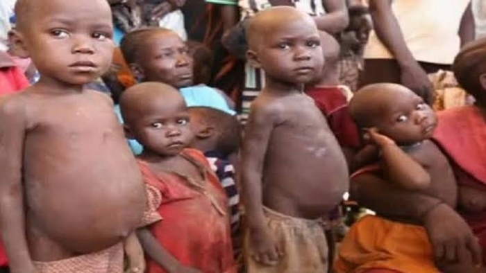 Nigeria has highest number of malnourished children in Africa, second globally - UNICEF