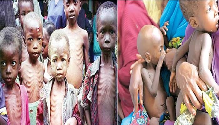 Editorial: Addressing the malnutrition crisis amidst growing revenues for the three tiers of government